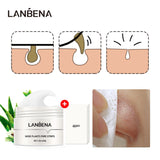 LANBENA Face Blackheads Remover Peel