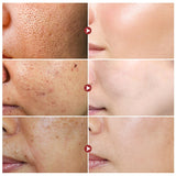 Pore Shrinking Dark Spots Face Serum