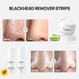 LANBENA Face Blackheads Remover Peel