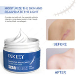 INKEEY Scar Removal Cream Fade Acne Scar Spots Treatment Stretch Marks