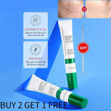 20g Salicylic Acid Acne Removal Cream Acne Treatment Moisturizing Oil