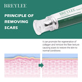 BREYLEE Acne Scar Removal Cream  Skin Remove Stretch Marks Repair Skin Care